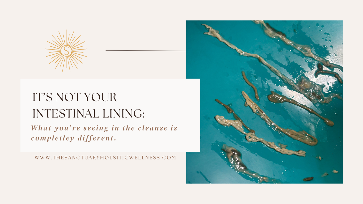 IT’S NOT YOUR INTESTINAL LINING.